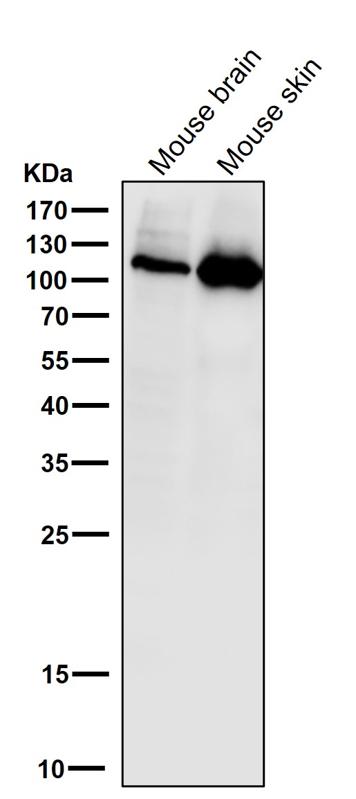 WB - Anti-PI 3 kinase p110 alpha Monoclonal Antibody ABO14359